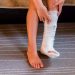 Fractura de Tibia y Peroné